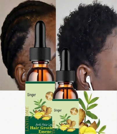 huile-essentielle-pour-la-croissance-des-cheveux-big-0